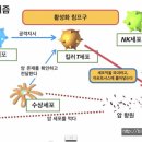 암 세포와 면역 세포와의 싸움 이미지