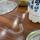 디디에이치아이 | 최고의 성형 교정!디디하임 투명교정 후기