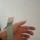 얼굴잡티제거 포토나레이저 토닝 후기 효과