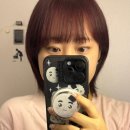 9 | [후기] #4 홍대 퀵매몰 쌍수 (9개월 후기)