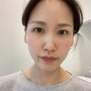 미파문피부과의원 | 리쥬란힐러 3후기, 신논현역 피부과