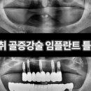 강도욱치과의원 네이버블로그