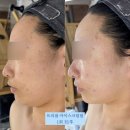 움트다 에스테틱 | 마곡피부관리 추천｜내돈내산까지 하게 된 움트다 에스테틱 아이스크림필 후기 ｜ 강서구 예신관리