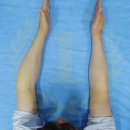 강남챔피언정형외과의원 | 보험 청구 가능한 휘어진 팔, 휜팔, 내외반주수술은 강남챔피언정형외과