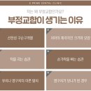 에스프라임 이미지