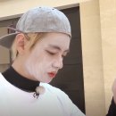 [깨털기 프로젝트] 깨가 다 털렸나? 목동 정영철피부과 주근깨 기미 잡티제거 레이저시술 내돈내산...