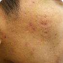 휴본한의원 이미지