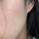 오로라광고디자인 | 뷰티디바이스 추천 결혼 앞두고 칙칙해진 예비 신부 오로라 더마샷으로 깐달걀 신부 화장 성공한 후기