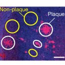 알츠하이머병 예방을 위한 리튬 보충제 이미지