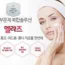 멜라즈