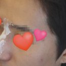 위너성형외과의원 네이버블로그