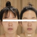 부산윤곽관리 디브레인 황금비에스테틱 부산개금에서 윤곽 변화로 제대로 힐링