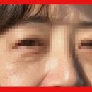 백옥 티스토리