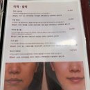 소노에이블 | [공지] [안양 에스테틱] 에이블메디스킨 선불권 결제 후 첫 시술, 프락소노 솔직 방문 후기 💆‍♀️✨