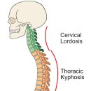 메디인스트롱 이미지