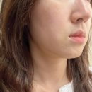 더 트리니티 스파 송도점 | 송도피부관리 더트리니티스파 송도점 윤곽 리모델링 솔직 후기