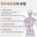 삼호종합상가 | 신논현 필라테스 / 척추측만증 워크샵 후기 (Scoliosis Workshop)