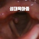 성대 이미지