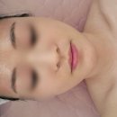 울산 삼산동 피부관리 시크릿영 스킨부스터 속광채우는 탄력관리 MTS 후기