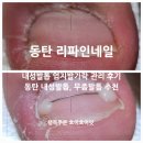 디에고푸스 동탄점 리파인네일