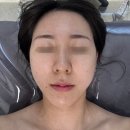 신장동피부관리 1대1 맞춤형 관리 <아라뷰티케어> 후기