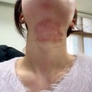 플러스메드 | 성인 아토피 관리템 리뷰 | 로션·크림·밤·연고·패치 그 외 내돈내산 별점후기 - 1편