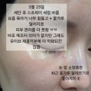 임신 출산 후 소양증에 유이브 화장품 두달 이상 사용한 찐 후기
