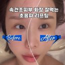늘,봄 뷰티 | 속건조 피부, 초음파 리프팅으로 촉촉해짐! 위례 올가드림뷰티 리얼 후기