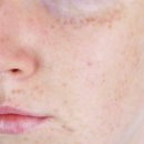 더힐피부과의원 이미지