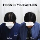 나는 소년이었다 SMP 이미지