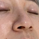 사북선명아파트 출구 앞 | [올가드림뷰티 해운대래미안점]에서 블랙헤드 박멸하고 온 후기 모공 디톡스 강추