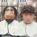 블랭크유 대전시청점 | M자 커버 증모술, 많은 탈모인이 인정한 그곳