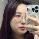 인천 검단 내 돈 내산 인모드Fx 6회 후기,, 지옥의 인모드를 아십니까?
