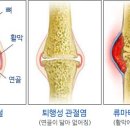 5월9일 월요일///퇴행성 몸의 관절에 좋은 음식 이미지