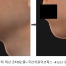 스프링봄봄