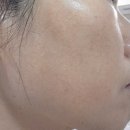 라곰스토리 | 달리기에 진심인 나의 원픽 홈케어, 팍스초이스 비타민C세럼 & 나이아신아마이드세럼 솔직한 변화 기록