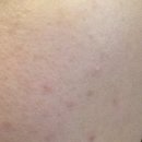 필바이오 이미지