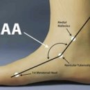 정메디케어 이미지