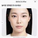 뷰티렐라 | 성형외과 안가도 코 성형전후 확인가능한 AI얼굴분석 뷰티렐라 사용후기