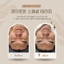 장기동 에스테틱 :: 퍼나머널 뷰티 시그니쳐 프로그램 경이로운 스페셜 테라피