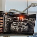 꼬마이치과의원 | 부천 놀이방 있는 어린이 치과 추천 꼬마이치과 영유아 구강검진, 불소도포 시기