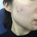 두드림휘트니스 | [전동클렌저vs루미스파] 왜 전용젤까지 써야할까? 내돈내산 사용후기