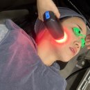 수피부과의원 | 청담피부과의원 티타늄리프팅 후기 일주일 효과