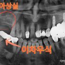 바른이안치과의원 이미지