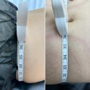 제육폭식인천 | 인천원당동에스테틱 피부보다 더 시급한 뱃살관리 후기!