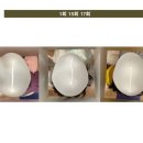 리샘한의원 | 내돈내산) 분당 리샘한의원 분당점에서 소아 두상 교정 받은 후기 #2