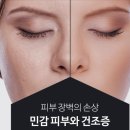 피부장벽의 손상 :: 민감 피부와 건조증 이미지