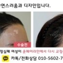 라인헤어 이미지