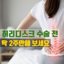 OIL LAB | 허리 디스크 진단받았다면 수술 결정하기 전 딱 2주만 이것 끊어보세요(인스턴트/염증 관리)