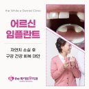 the 화이트e 치과의원 | 부산 명지 치과 어르신임플란트 건강보험을 이용한 합리적인 선택
